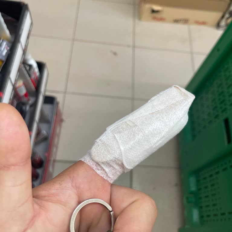 Düzce Çilimli Hastanesinde Sert Müdahale Ve Yanlış Atel Uygulaması