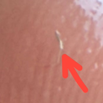 Burcu Konservesinde Sivri Metal Parça Sağlık Riski Oluşturdu