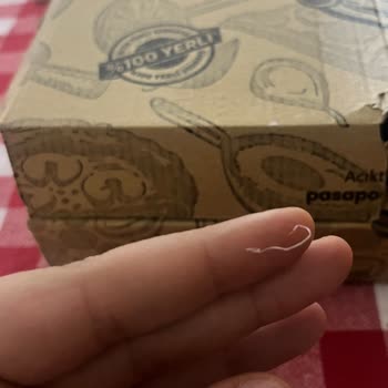 Sert Ve İnce Hamurlu Bayat Pizza, İçindeki Ambalaj Parçası Hijyen Endişesi Ve Restorandan İade Reddi