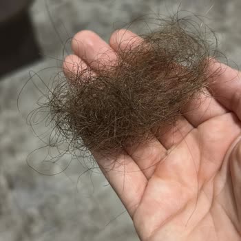 Sec Hair Studio Saçlarım İşlem Sırasında Kopmaya Başladı
