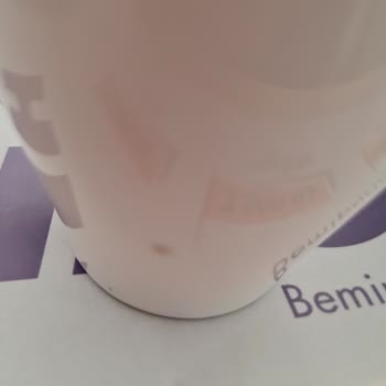 DHL’nin Ücretsiz İade Teslimini Reddetmesi Ve Çifte Ücret Talebi
