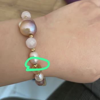 Altın Kaplamalı Bilekte Renk Solması Ve Boncuk Kararması, Garanti Kapsamında Çözüm Talebi