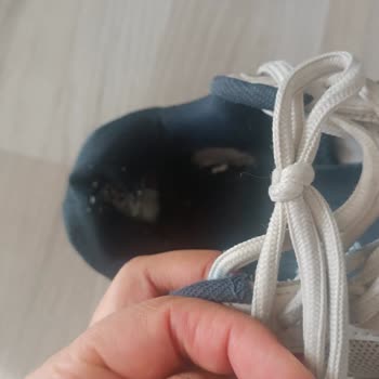 FLO Mağazasının 2 Yıl Garantili Ayakkabının Açılma Ve Yıpranma Şikayeti Reddedildi