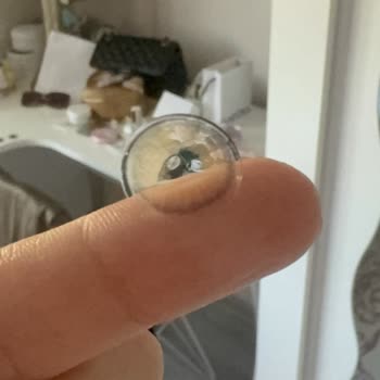 Üretim Hatası Lens: Şiddetli Yanma, Sert Bölge Ve İade Talebi