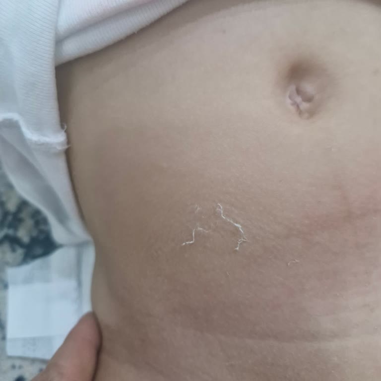 Sleepy Bebek Bezinde Pamuk Parçalarının Cilde Yapışması Ve Hijyen Endişesi