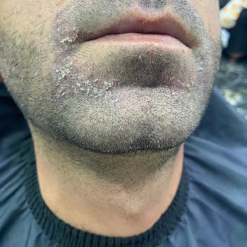 Yves Rocher Şampuanı Kepek Sorununu Çözmedi
