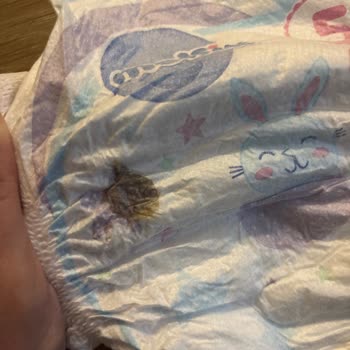 Molfix Mavi Bezlerde Kir Ve Sağlık Riski