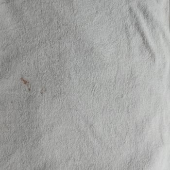 Daima Biz Otelinde Temizlik Sorunları, Çalışmayan Asansör Ve Düşük Yemek Kalitesi