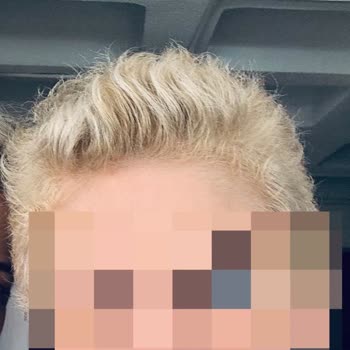 Palette Saç Boyası Beklenmedik Pembeye Dönüştü: Renk Faciası Ve Çözüm Talebi