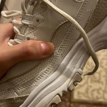 Skechers Ayakkabısının Kısa Sürede Çatlaması Ve Kusur Bulunmadığına Dair Olumsuz Cevap