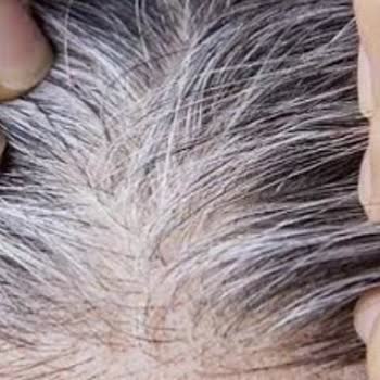 Saç Boyasında Beyaz Kapatma Vaadi Karşılanmadı Ve Ekstra Zarar Görüldü