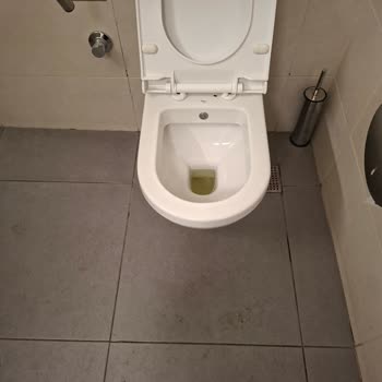 Etlik Şehir Hastanesi Acil Servis Tuvaletleri Kirli Ve Sağlık Riski Oluşturuyor