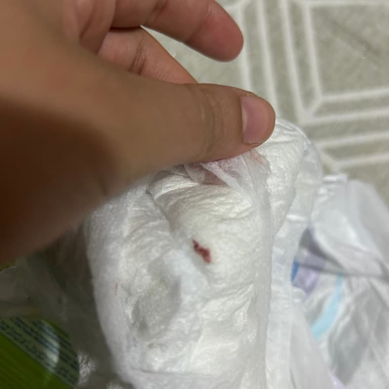 Açılmamış Molfix 6 Numaralı Bebek Bezinde Kırmızı Lekeler Ve Hijyen Endişesi