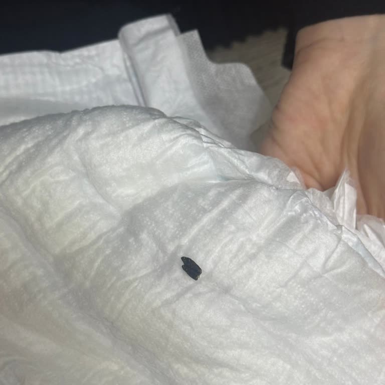 Molfix Bebek Bezinde Siyah Yabancı Madde Ve Hijyen İhlali