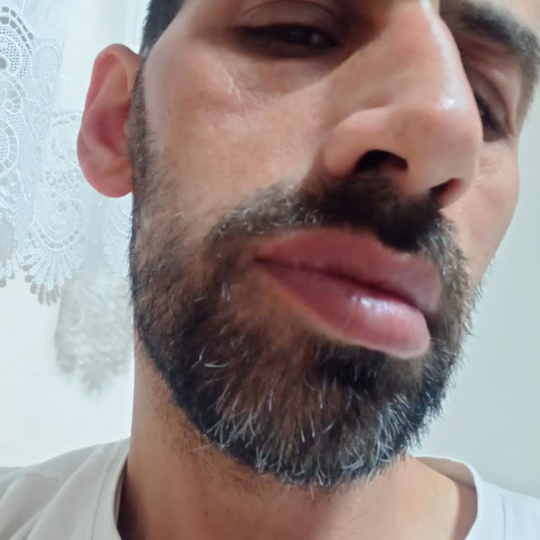 Derin Kanal Tedavisi Sonrası Şiddetli Ağrı Ve Şişlik