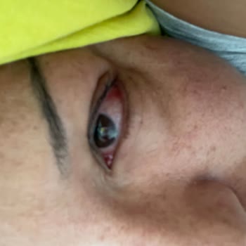 Flormar Extreme Tattoo 05 Very Berry Göz Kalemi Şiddetli Göz Reaksiyonu Ve Sağlık Riski