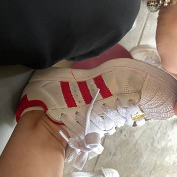 Adidas Superstar Ayakkabısında Hızlı Yıpranma Ve Garanti İhmalinden Şikayet