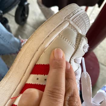 Adidas Superstar Ayakkabısında Hızlı Yıpranma Ve Garanti İhmalinden Şikayet