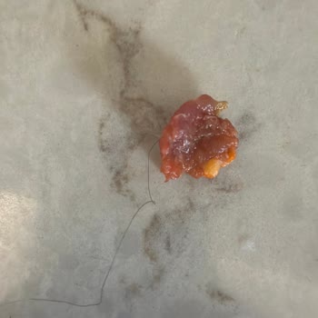 Köfteci Yusuf’ta Saç İçeren Kıyma Ve İade Reddi