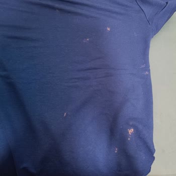 Vanish Oxi Advance Kullanımına Rağmen Kıyafetlerimde Yeni Lekeler Oluştu Ve Kullanılamaz Hale Geldi