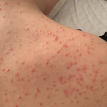 Sağlığı Tehlikeye Atan Kilo Aldırıcı Toz Form Ürün Ve Firmanın Umursamaz Tutumu