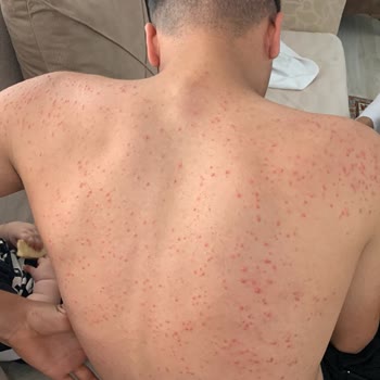 Sağlığı Tehlikeye Atan Kilo Aldırıcı Toz Form Ürün Ve Firmanın Umursamaz Tutumu