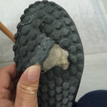 Ayakkabının Tabandan Parça Kopması Ve Ağır Yaralanmaya Neden Olması