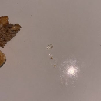 Ercan Usta Lahmacun Pide Sipariş Eve Geldikten Sonra Yerken İçinden Cam Kırığı Çıktı