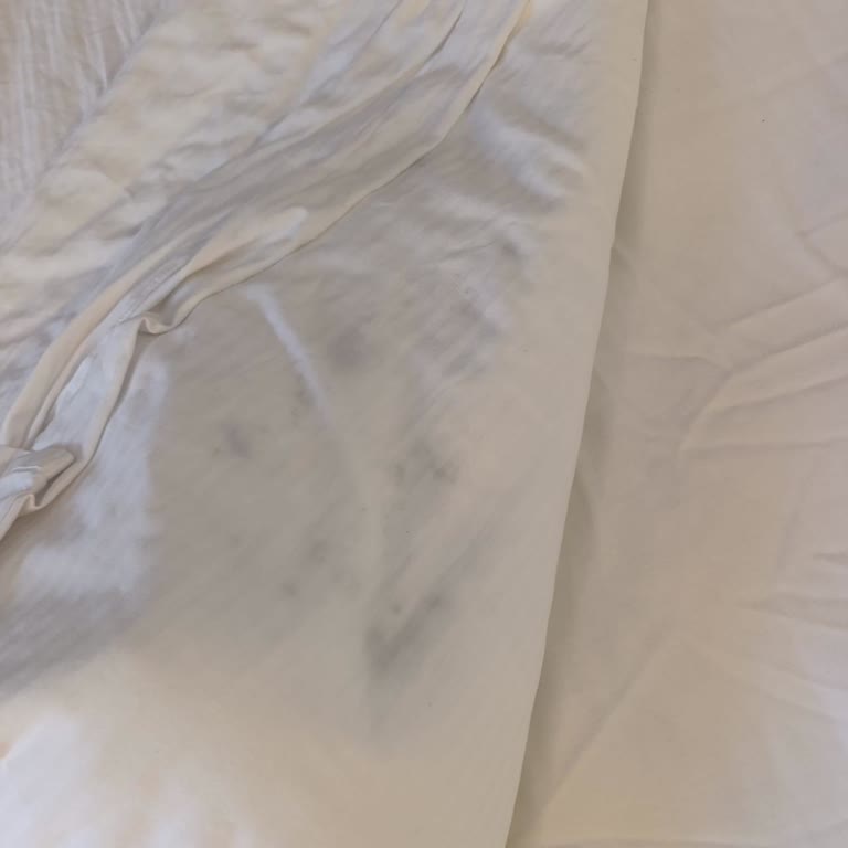 Sunis Elita Beach Resort Hotel Odalarda Yoğun Rutubet Kokusu