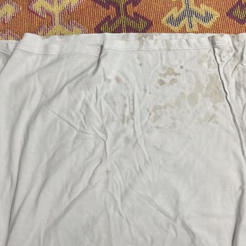 Araba İçinde Kıyafetler Lekelendi Ve Kötü Koku, Personelin Saygısız Tutumu