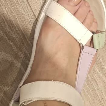 Deichmann Sandaletinde Kısa Sürede Su Birikmesi Ve Yara Açması