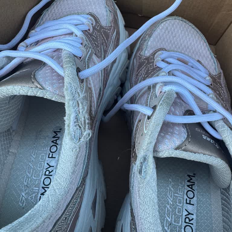 Kısa Sürede Deforme Olan Skechers Ayakkabı Kullanıcı Hatası Şeklinde Reddedildi