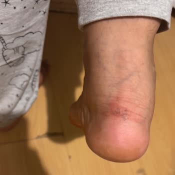 Ayakkabı Cildi Tahriş Etti, Mağaza Personeli Saygısız Davrandı