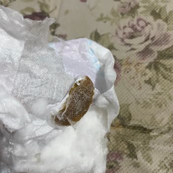 Molfix Bebek Bezinde Kahverengi Yabancı Madde Tespit Edildi