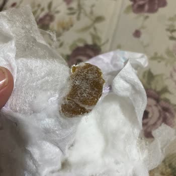 Molfix Bebek Bezinde Kahverengi Yabancı Madde Tespit Edildi