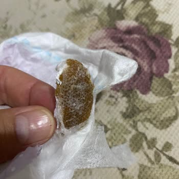 Molfix Bebek Bezinde Kahverengi Yabancı Madde Tespit Edildi