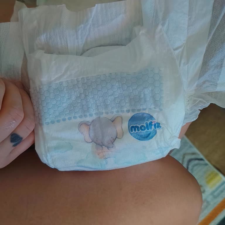 Molfix Bebek Bezlerinde Üretim Hatası: Ücret İadesi Talebi