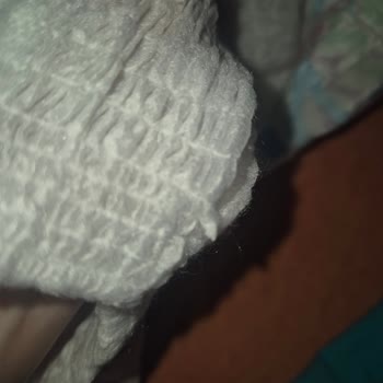 Molfix Bebek Bezi Keskin Çapaklar Nedeniyle Cilt Tahrişi Ve Ürün Yırtılması