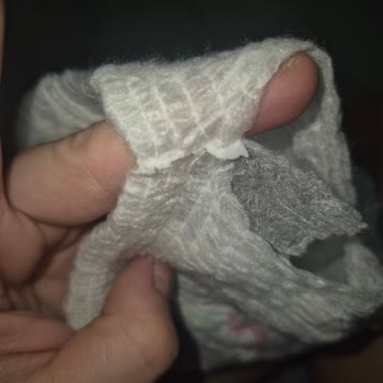 Molfix Bebek Bezi Keskin Çapaklar Nedeniyle Cilt Tahrişi Ve Ürün Yırtılması