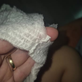 Molfix Bebek Bezi Keskin Çapaklar Nedeniyle Cilt Tahrişi Ve Ürün Yırtılması