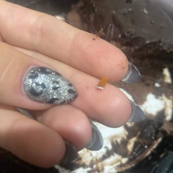 Pastada Metal Parçası Bulunması Ve Diş Hasarı Riski