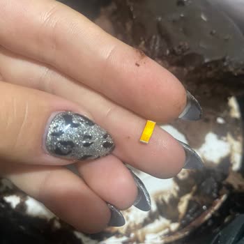 Pastada Metal Parçası Bulunması Ve Diş Hasarı Riski