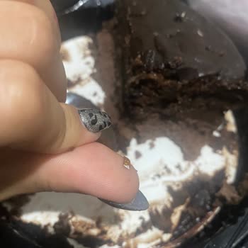 Pastada Metal Parçası Bulunması Ve Diş Hasarı Riski