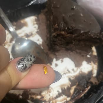 Pastada Metal Parçası Bulunması Ve Diş Hasarı Riski