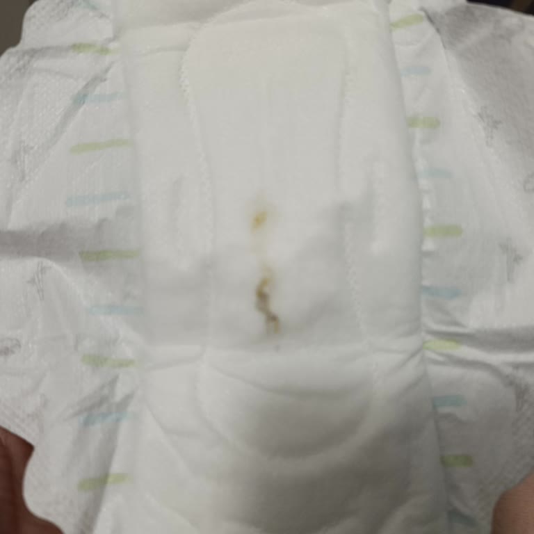 Yeni Pedde Sert Yabancı Madde: Sağlık Ve Hijyen Endişesi