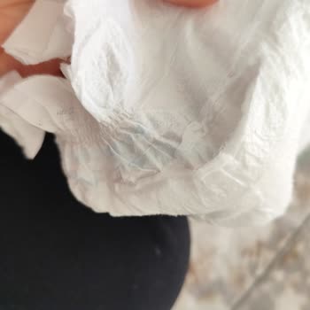 Molfix Bebek Bezlerinde Yırtık Ve Emici Tanecik Dökülmesi
