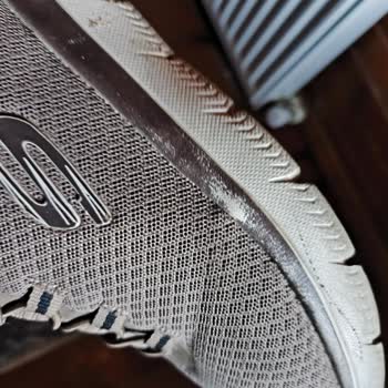 Skechers Ayakkabısının Bir Yıldan Önce Aşırı Yıpranması Ve Garanti Talebi