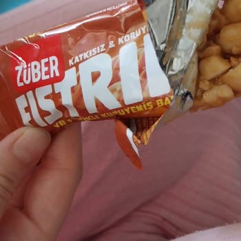 Züber Yer Fıstıklı Kuruyemiş Barında Kıl Bulunması Ve Hijyen Şikayeti