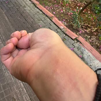 Doramar Tatil Köyü’nde Hijyen Çöküşü Ve Sağlık Riski