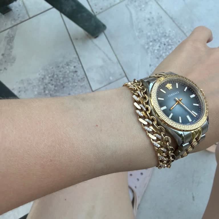 Versace Saatinde Bilek Boyaması Ve Cevapsız Müşteri Hizmeti